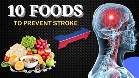 Eating for Stroke Preventio