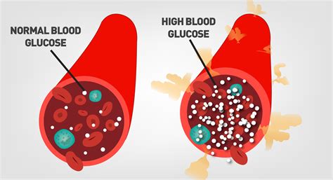 How many sugar are in healthy vision - calories, carbs, nutrition