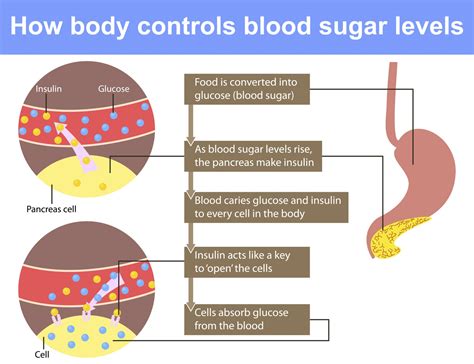 How much fat is in dextrose - calories, carbs, nutrition