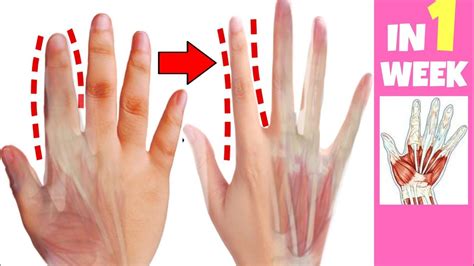 How much fat is in fingers - calories, carbs, nutrition