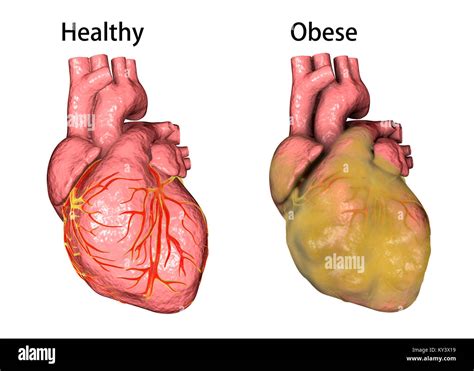 How much fat is in hearts - calories, carbs, nutrition