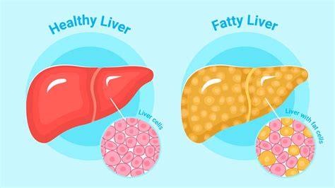How much fat is in liver & bacon hot-pot with peas & carrots - calories, carbs, nutrition